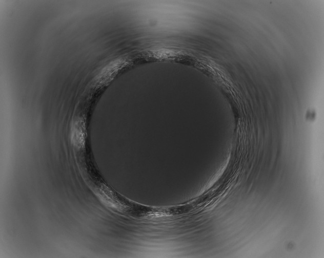 X0000099380644200806051122