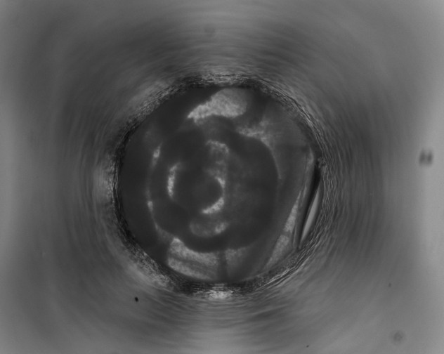 X0000099380647200806051122