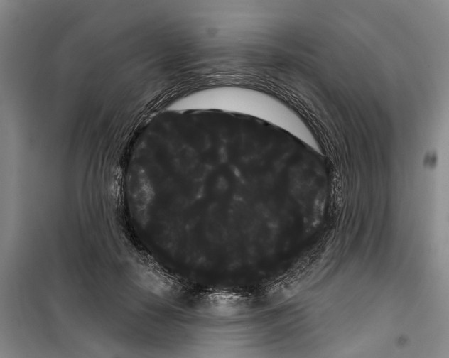 X0000099380650200806051122