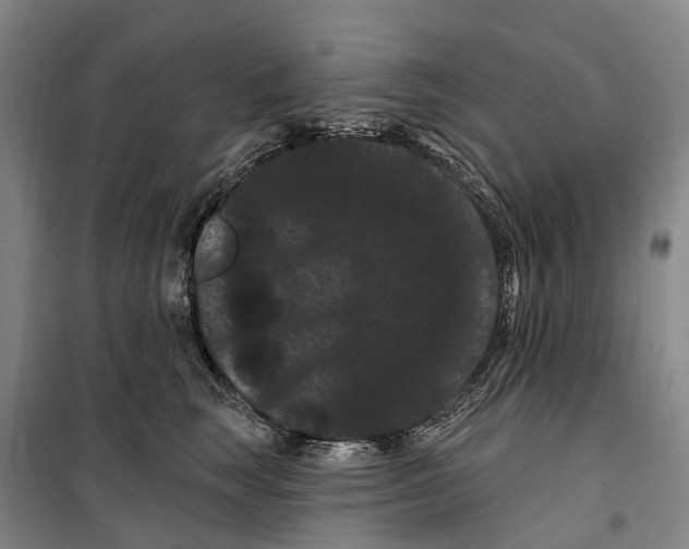 X0000099380663200806051122