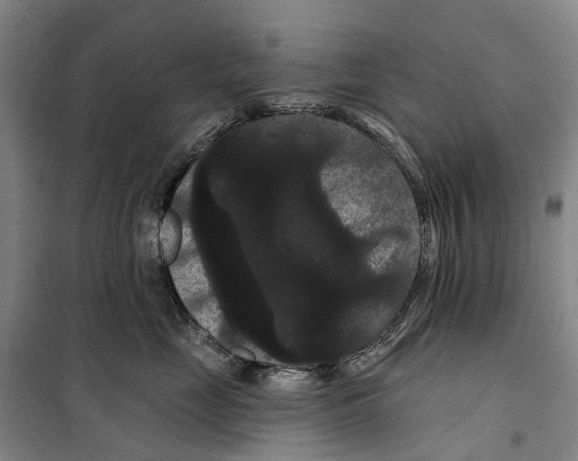 X0000099380669200806051122