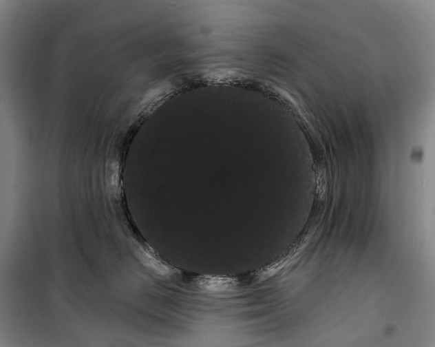 X0000099380670200806051122