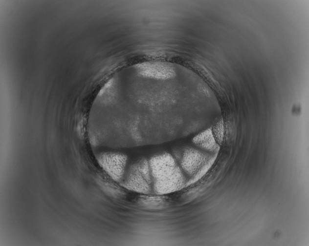 X0000099380671200806051122
