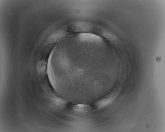 X0000099380672200806051122