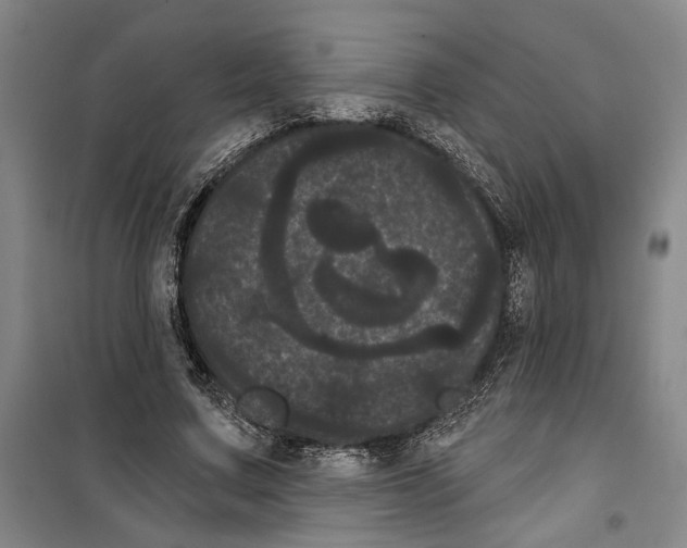 X0000099380683200806051121