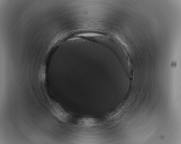 X0000099380685200806051121