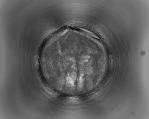 X0000099380692200806051121