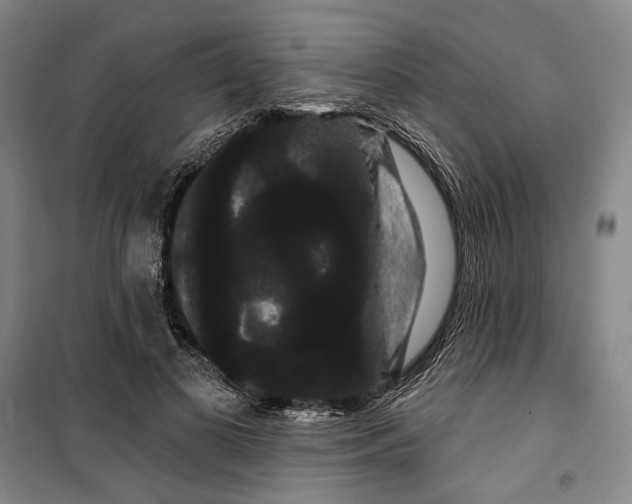 X0000099380693200806051121