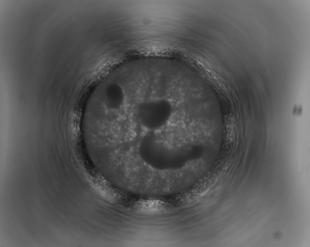 X0000099380695200806051121