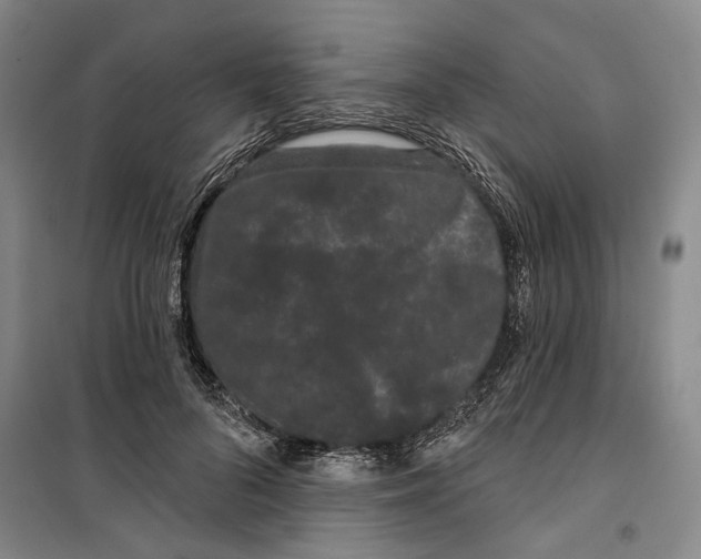 X0000099380696200806051121