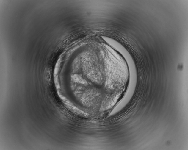 X0000099380699200806051121