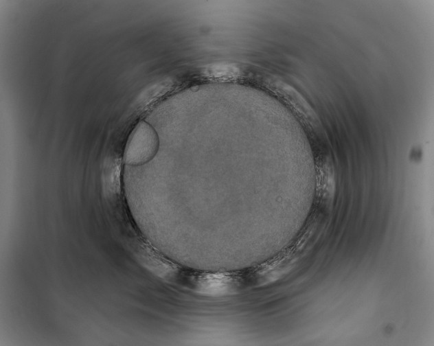 X0000099380717200806051121