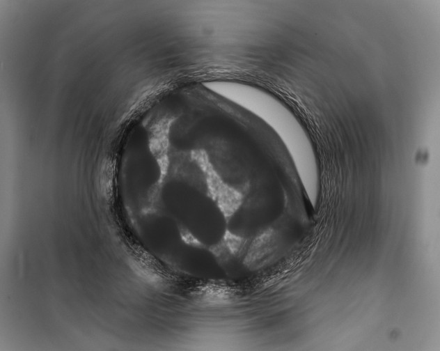 X0000099380742200806051120