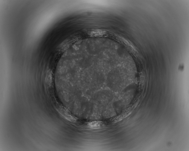 X0000099380761200806051121