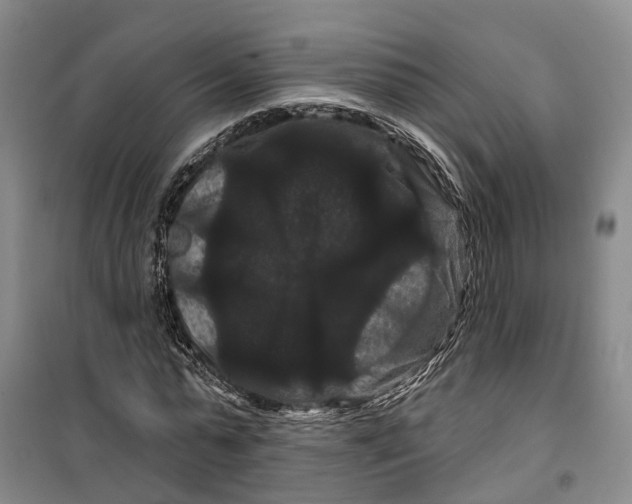 X0000099380775200806051120