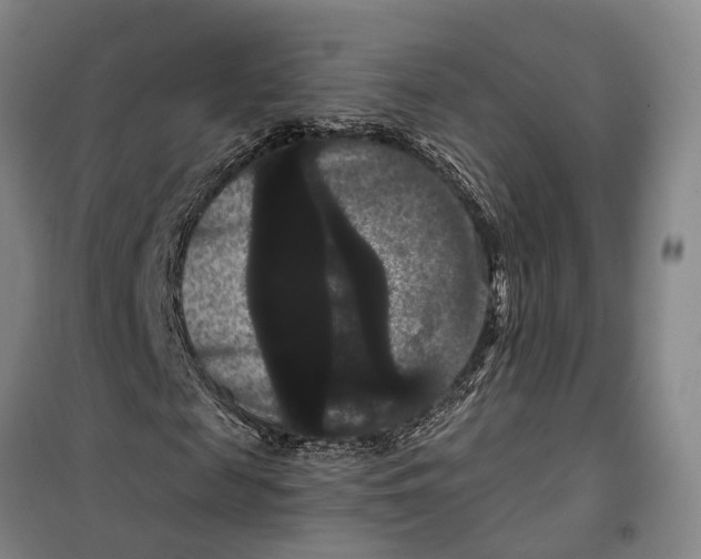 X0000099380817200806051119