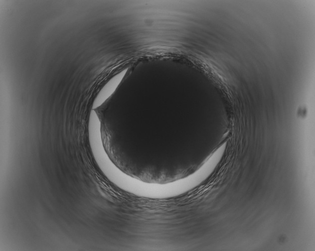 X0000099380868200806051118