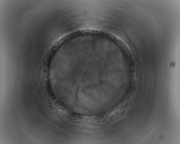 X0000099380870200806051118