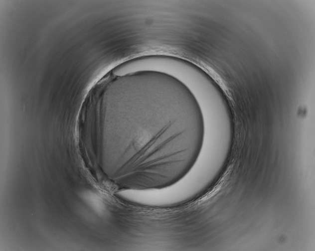 X0000099380885200806051118