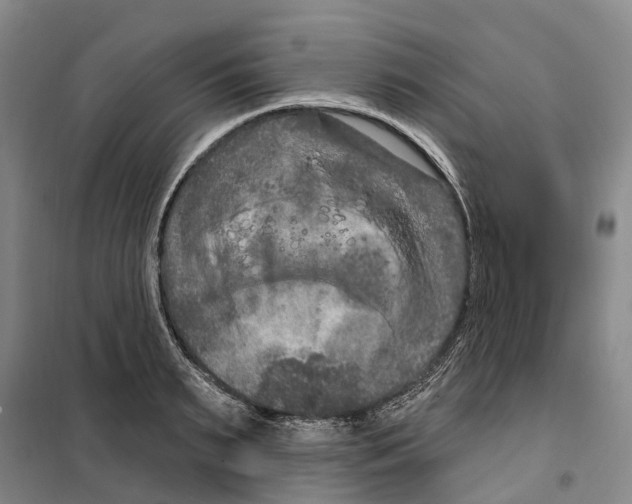 X0000099380895200806051118