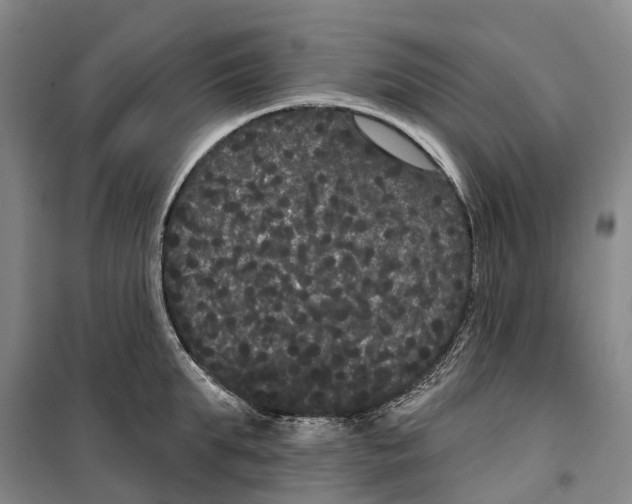 X0000099380903200806051118