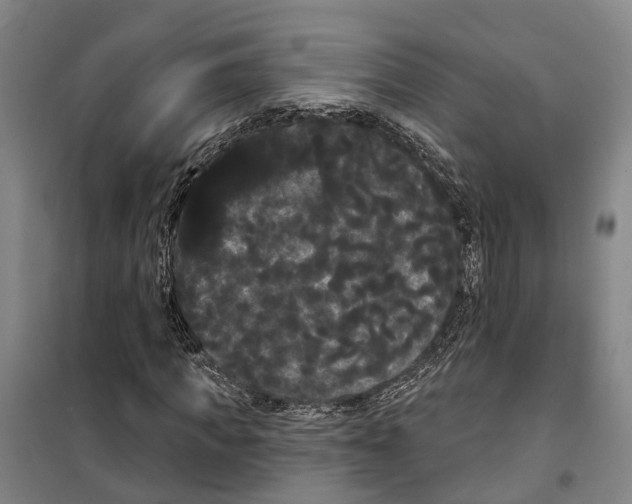 X0000099380917200806051117