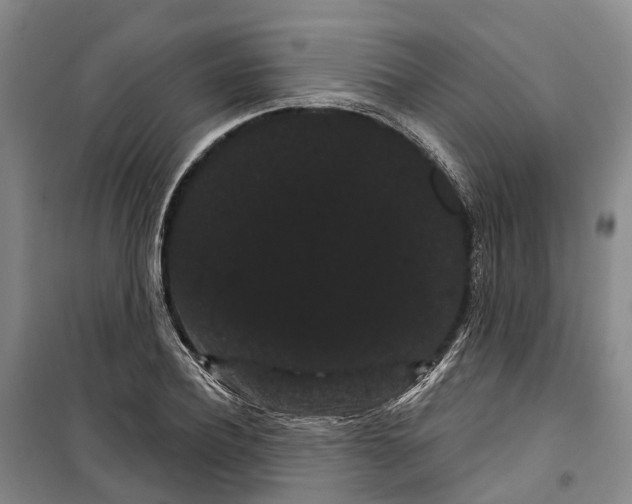 X0000099380932200806051117