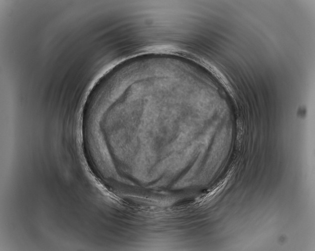 X0000099380939200806051118