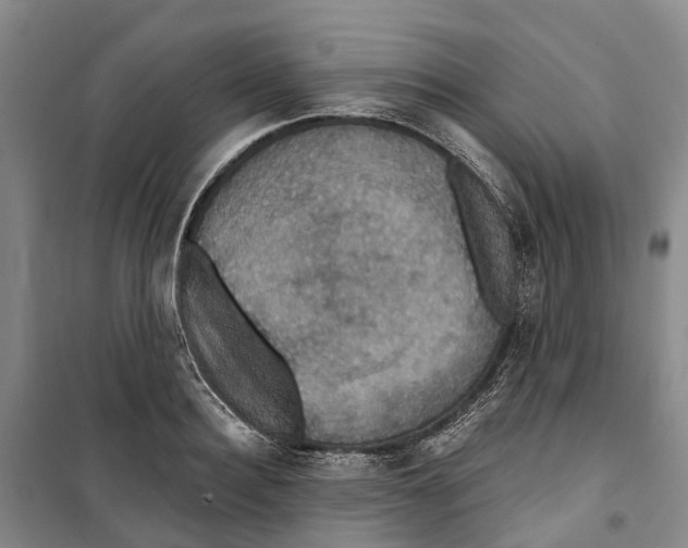 X0000099380940200806051118