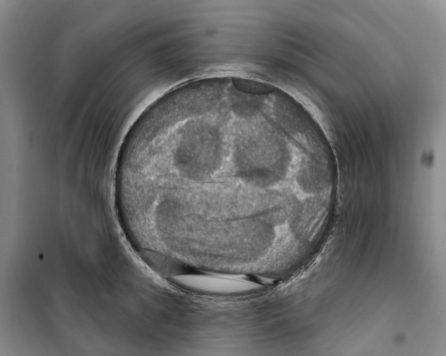 X0000099380949200806051118