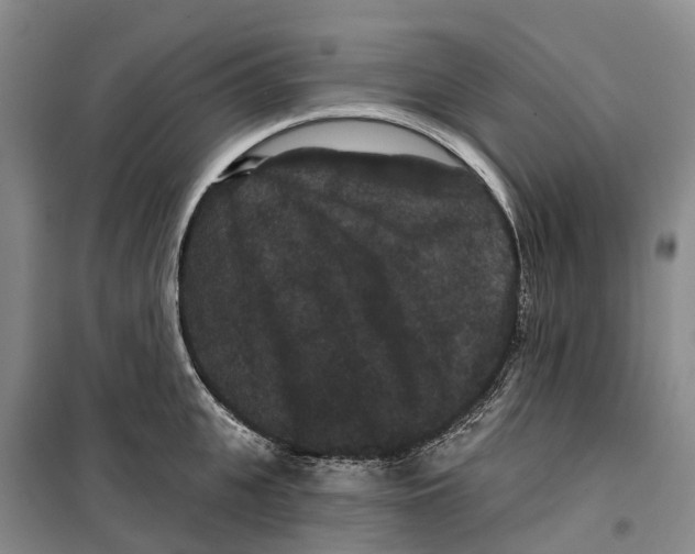 X0000099380951200806051118