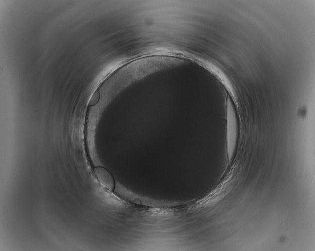 X0000099380954200806051118