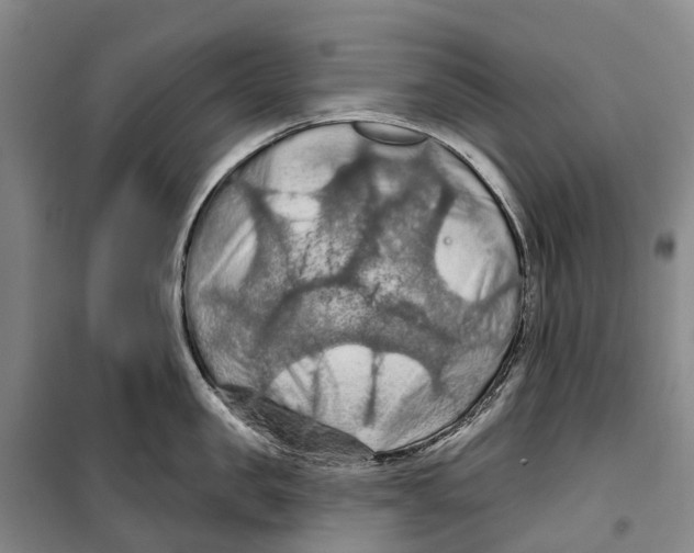 X0000099380957200806051118