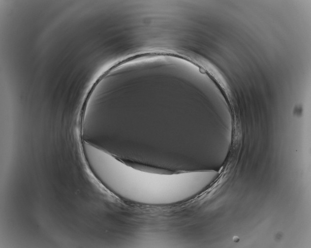 X0000099380958200806051118