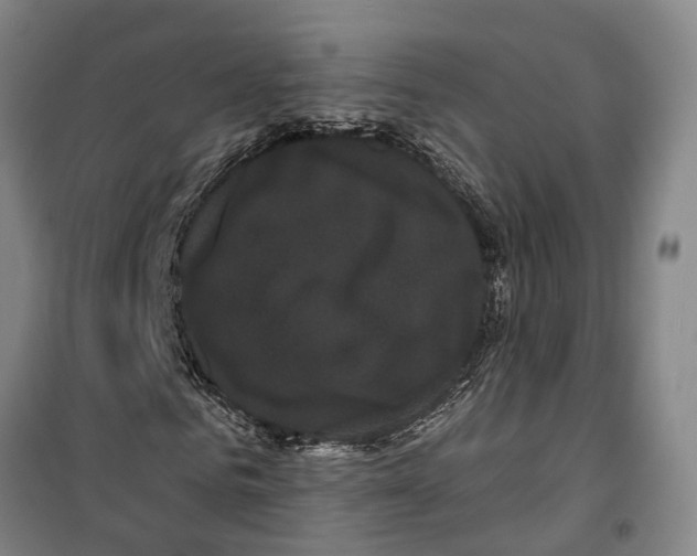 X0000099380961200806051117