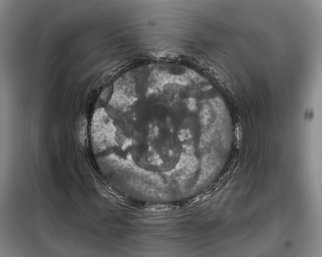 X0000099380963200806051117
