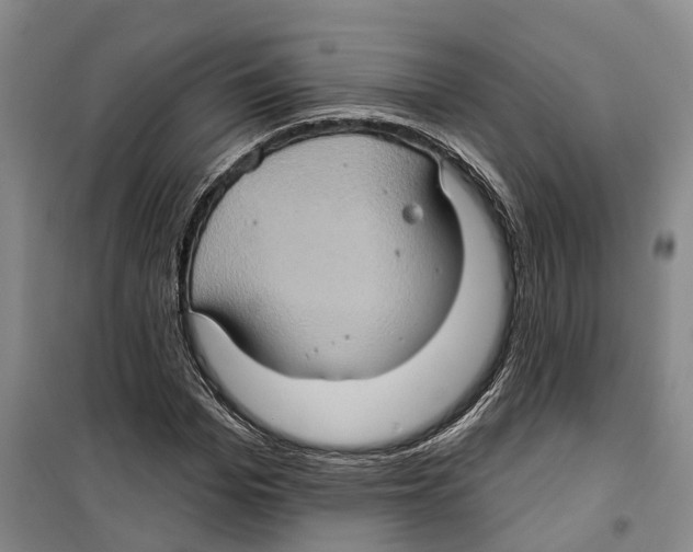X0000099380969200806051117
