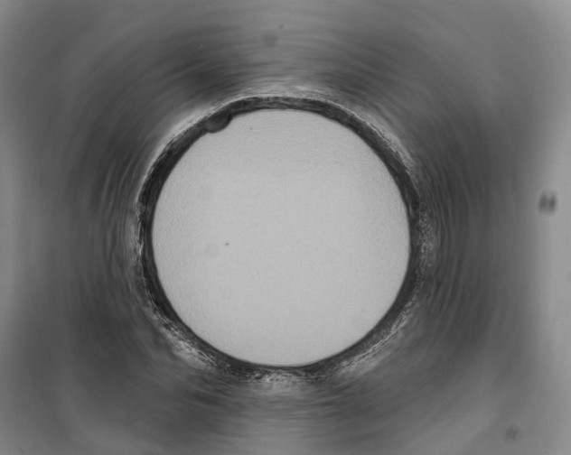 X0000099380974200806051117