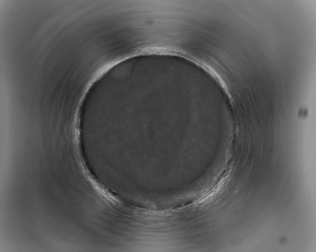 X0000099380981200806051117
