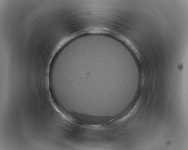 X0000099380986200806051117