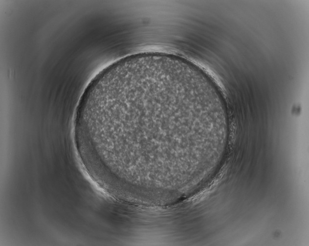 X0000099380991200806051117