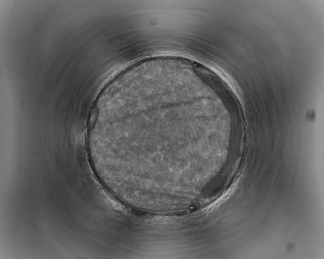 X0000099380993200806051117