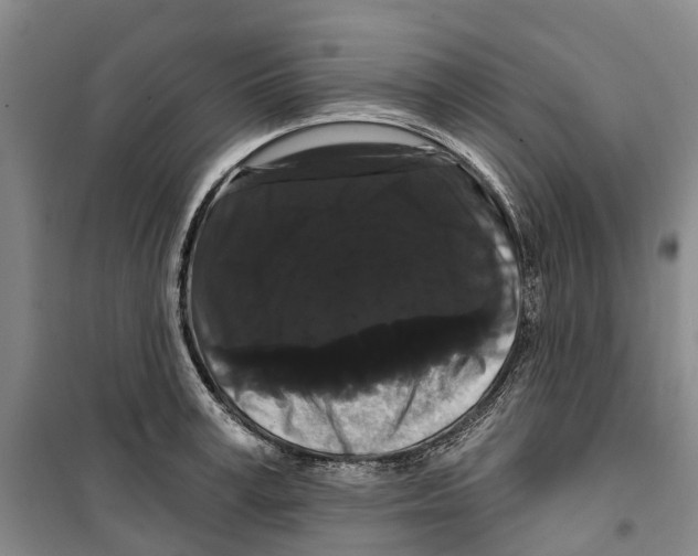 X0000099380995200806051117