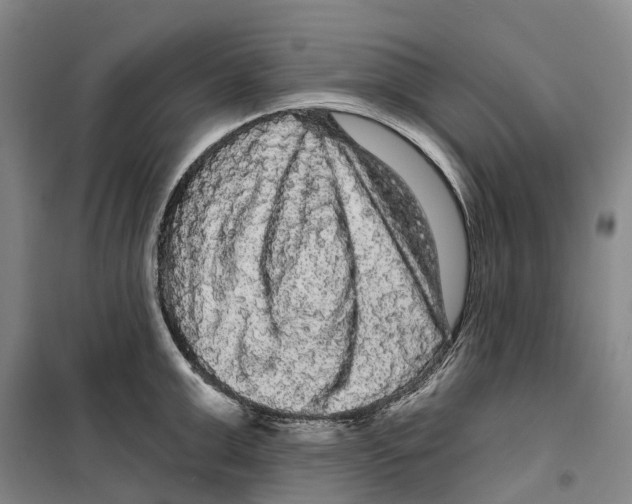 X0000099380999200806051117