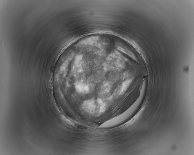 X0000099381001200806051116