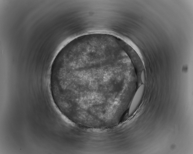 X0000099381005200806051116