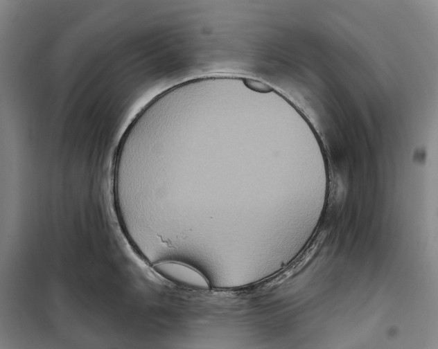 X0000099381006200806051116