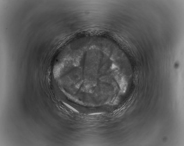 X0000099381010200806051116