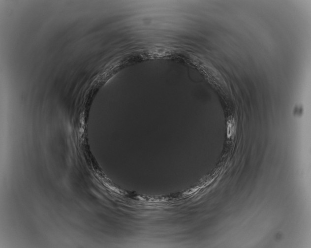 X0000099381011200806051116