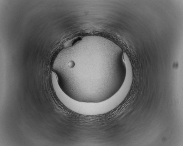 X0000099381012200806051116